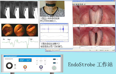 吞咽评估系统 EndoStrobe